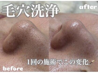 リリーラボ(LILY LAB)の写真