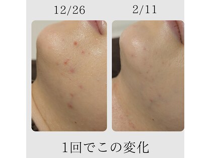 ベル(Belle)の写真
