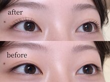 ツインズアイラッシュ(TWINS Eyelash)/逆まつ毛卒業