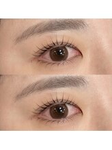 フリルビューティー(Frill beauty)/上下パリジェンヌラッシュリフト