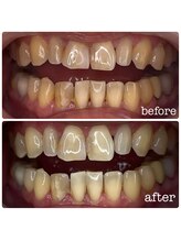 ビューティールームウィズ(beauty room w/)/