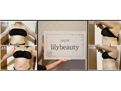 リリービューティー(lily beauty)の写真