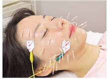 さくら治療院くまもと/フェイスラインのゆるみにw電気