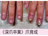 《深爪/爪噛み/むしり癖》卒業したい！クリア仕上・気づかれないマット仕上も