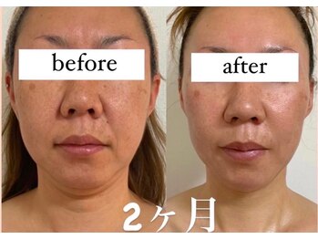 デュモンド(dumonde)