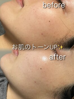 リイル バイ クレビア(REILE by Crebia)/お客様写真