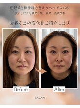 ラマジ(Lamazi)/小顔矯正