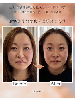 ラマジ(Lamazi)/小顔矯正