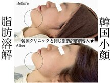 リベルキョウト 京都駅前店(Liber Kyoto)/レモンボトル超え!二重顎撃退