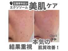 ビューティサロン ダブル 三田店(beauty salon W)の雰囲気（自然にあの頃のお肌に。全悩み対応の美肌エステ）
