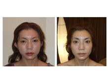 アゴラ/【小顔】豊富な施術実績有り