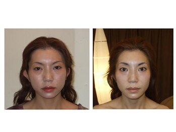 アゴラ/【小顔】豊富な施術実績有り