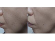 サロン リーナ 北千住店(Salon Lena)/こだわりの自社製品VinatuleVC30