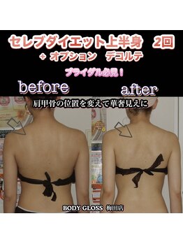 ボディグロス 梅田店(BODY GLOSS)/肩甲骨寄せて肩幅狭く華奢見えに