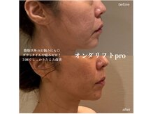 リビア(LIVIA)の雰囲気(脂肪だけじゃなくたるみ改善も!リビア独自の施術方法で最短結果)