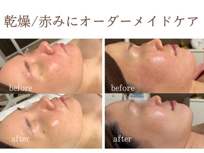シーラックス(Sealax)の写真