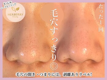 ハーバリー ハーブピーリング 難波心斎橋店(HERBERRYハーブピーリング)/なんばハーブピーリングHERBERRY