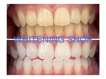 ホワイトニングショップ 立川店/【立川】美白ホワイトニング