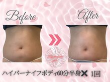 ワイキューマルサン(y903)/ハイパーナイフ上半身×1回