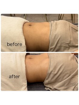 ジョワイユ(Joyeux)/腸の位置でお腹は変わる