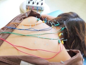 テイクケア(TAKEケア)の写真/《鍼灸師歴16年！》鍼の打つ本数はどこのサロンにも負けません！！整体マッサージ＋鍼灸40分¥7000