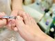 ランランネイル(rangrang nail)の写真/巻き爪矯正は痛いというイメージを覆す、綺麗な巻き爪補正◎多くの実績はブログをcheck◎