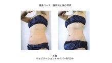 トータルエステティックサロン ヴィーナス(Venus)