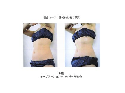 トータルエステティックサロン ヴィーナス(Venus)の写真