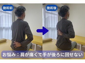 りびるど/肩こり、肩の痛みのケア