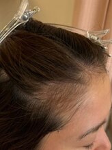 プロセルセラピーズ取扱店【withサロン天神大名店】ヘッドスパ/育毛専門店