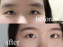 シエナ アイ(CIENA eye)/