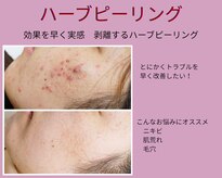 アンティクイーン(Antiqueen)