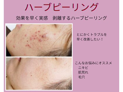 アンティクイーン(Antiqueen)の写真