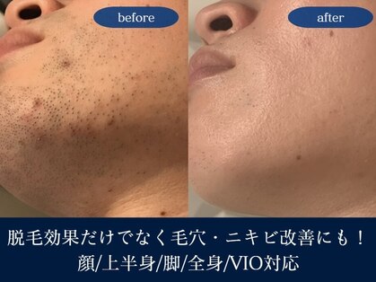 メンズ シャンティ(Men s SHANTI)の写真