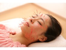 メイロン(meilong)/美容鍼灸60分