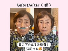 ヨサパーク ベアトリーチェ(YOSA PARK beatrice)/水素吸入のみ！