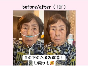 ヨサパーク ベアトリーチェ(YOSA PARK beatrice)/水素吸入のみ！