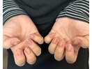 ちゅるんまぐネイル