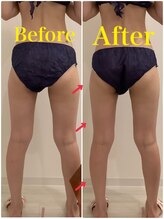 スペチアーレ 夙川/脚長効果抜群