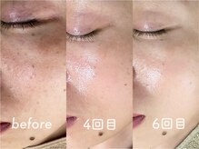 ウィル 二子新地(will)/艶玉肌ケア