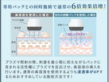 レミューズ(LES MUSES)/プラズマトリートメント