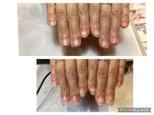 アンドネイル 海老名(&nail)/Before after