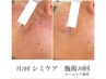 シミ改善＆リフトアップ特化【白玉スノーピール】　15000円→9800円　60分