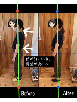 はまもと整骨院/整体・姿勢改善