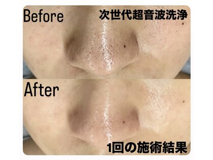 イリゼ(IRISE)の写真