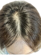 リセル(Recell)/育毛促進ケア