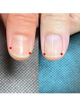 ルクレール カシェット(Le clair cachette)/美爪育成