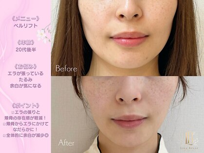 リリーベル 新宿歌舞伎町(Lily Belle)の写真