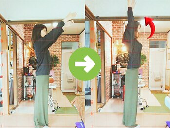 サプライズ整体院/20代ママさんの肩こり初回結果