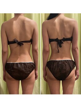 カルナ(CARNA)/最強トリプル痩身ケア